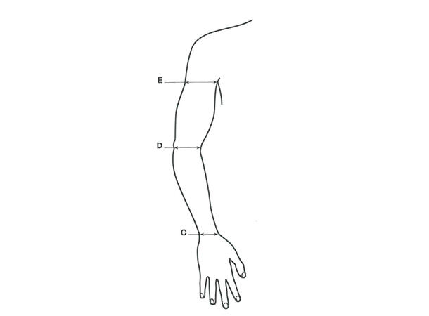 Mobiderm Arm STD  5+ Lang